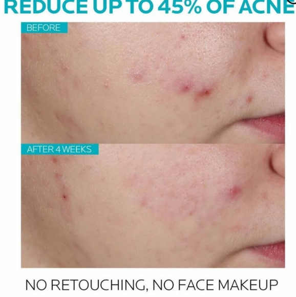 LA ROCHE POSAY EFFACLAR SALICYLIC ACID ACNE TREATMENT SERUM & CLEANSER - Picture 11 of 12